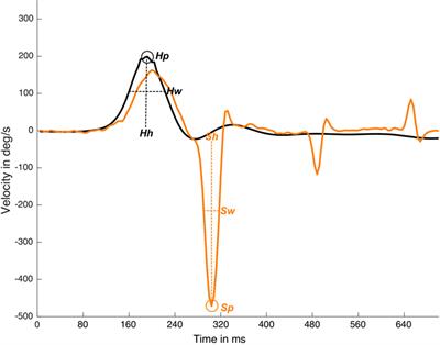 The Role of Predictability in Saccadic Eye Responses in the Suppression Head Impulse Test of Horizontal Semicircular Canal Function